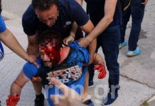 Άγριο ξύλο στο Αήττητος Σπατών-Εθνικός (pics/video)