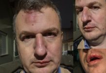 Ξυλοδαρμός του εκδότη της ΜΑΓΝΗΣΙΑΣ- Γρονθοκόπησαν τον Αρχιμήδη Καρεκλίδη έξω από το σπίτι του