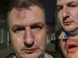 Ξυλοδαρμός του εκδότη της ΜΑΓΝΗΣΙΑΣ- Γρονθοκόπησαν τον Αρχιμήδη Καρεκλίδη έξω από το σπίτι του