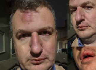 Ξυλοδαρμός του εκδότη της ΜΑΓΝΗΣΙΑΣ- Γρονθοκόπησαν τον Αρχιμήδη Καρεκλίδη έξω από το σπίτι του