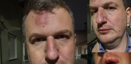 Ξυλοδαρμός του εκδότη της ΜΑΓΝΗΣΙΑΣ- Γρονθοκόπησαν τον Αρχιμήδη Καρεκλίδη έξω από το σπίτι του