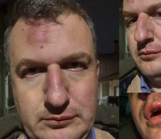 Ξυλοδαρμός του εκδότη της ΜΑΓΝΗΣΙΑΣ- Γρονθοκόπησαν τον Αρχιμήδη Καρεκλίδη έξω από το σπίτι του